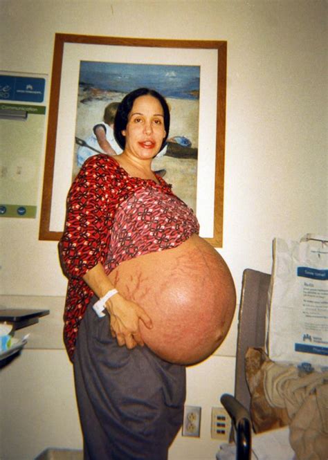 Nadya Suleman Also Known As Octomom T Ew An Ex E E Party To Celebrate Her Octuplets