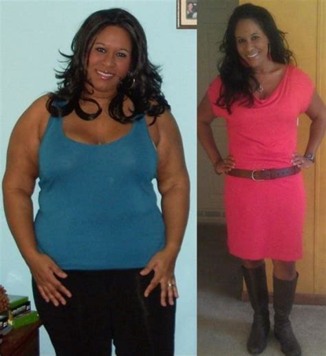 Amazing Weight Loss Before And After 30 Pics Picture 28