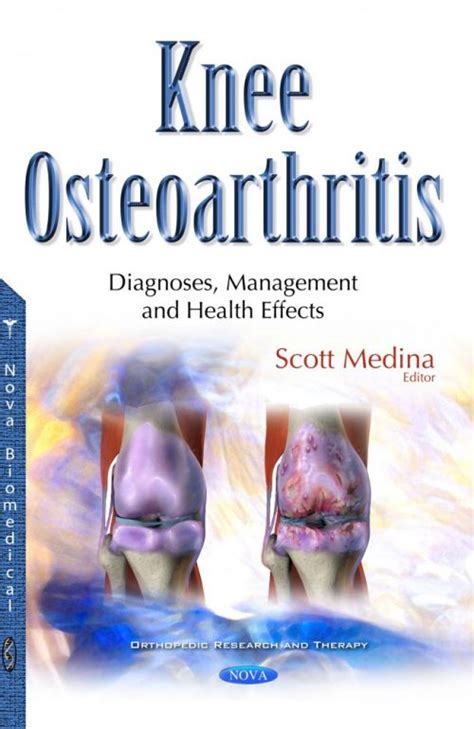 Knee Osteoarthritis Diagnoses Management And Health Effects Nova