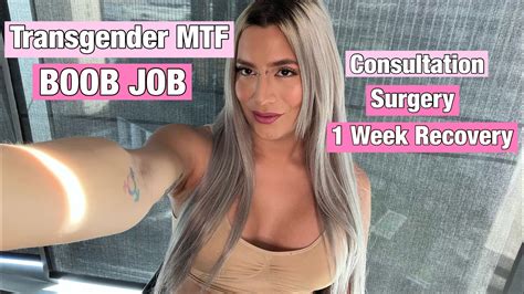 Transgender Mtf Breast Augmentation Week Recovery Youtube