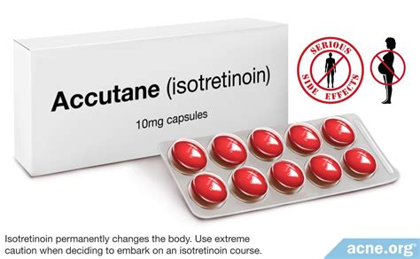 Accutane Isotretinoin How It Works Side Effects And Reviews