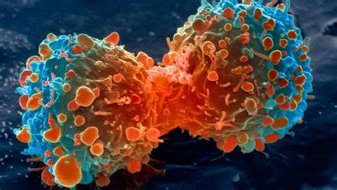 Cancerous Tumours Can Be Treated In Just Two Hours With This New