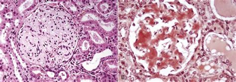 Neoplasia And Tumor Biology Veterian Key