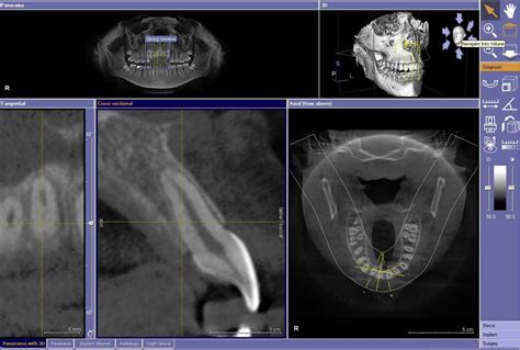 Cone Beam Ct Imaging Dentist Pasadena Tx Dr Nugent