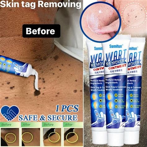 Sumifun Wart Remover Skin Tag Remover Body Cleans Skin Repair Cream