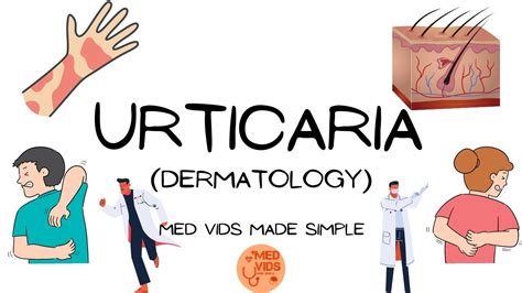 Urticaria Dermatology Pathophysiologyclinical Featuresdiagnosis