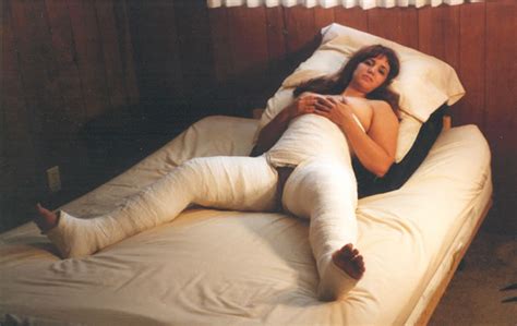Two Broken Legs In Casts Sexy Photos Pheonix Money