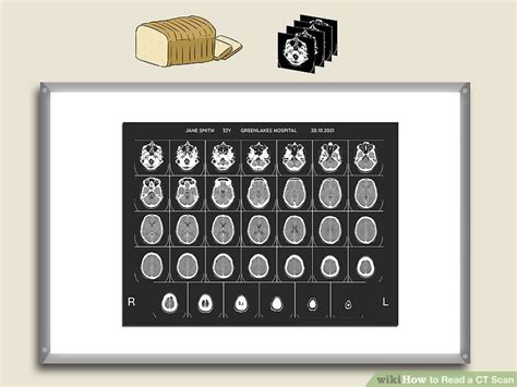 How To Read A Ct Scan Wiki Radiological Health
