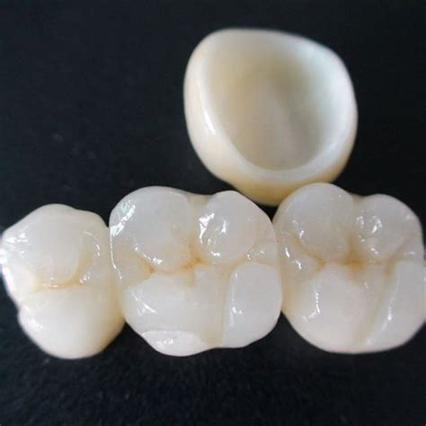 Do you want to learn about zirconium to discover if zirconium crowns are the right choice for you? Zirconia Crown, For Dental Clinic, Rs 1500 /unit, Ace ...