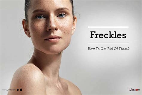 Freckles How To Get Rid Of Them By Dr Sharat Gupta Lybrate