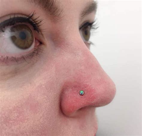 Redness Around Nose Causes And How To Get Rid Of Red Dry Skin On Nose