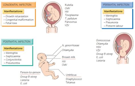 Congenital Infections Flashcards Quizlet