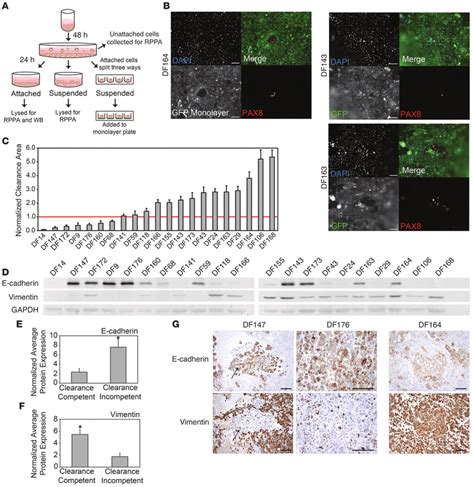Spheroids From Primary Ovarian Cancer Cell Lines Display Differential