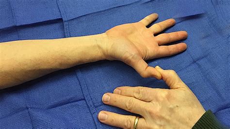 There are only a few fine stitches holding the repair together and these can easily be pulled apart. Muscle Test and Tendon Exam: Flexor Pollicis Longus (FPL) | Hand Surgery Source