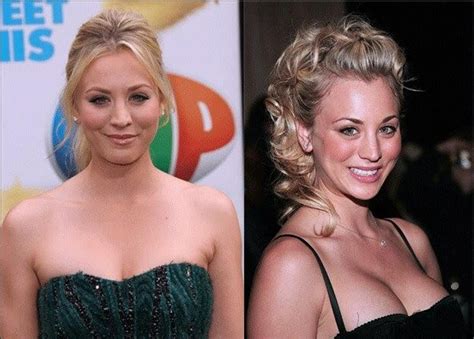 7 Celeb With Amazing Breast Implant Jobs