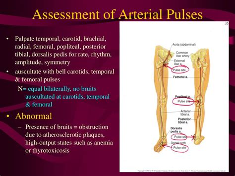 Femoral Pulse Palpation