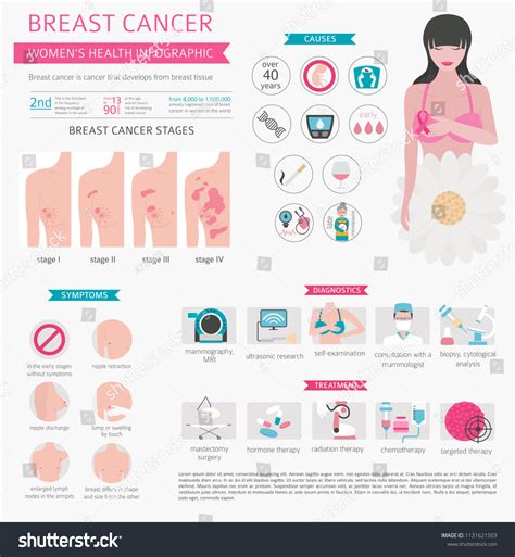 Breast Cancer Medical Infographic Diagnostics Symptoms 스톡 벡터 로열티 프리