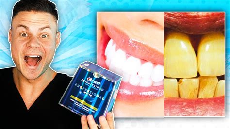 Whiten Your Teeth With Braces Youtube