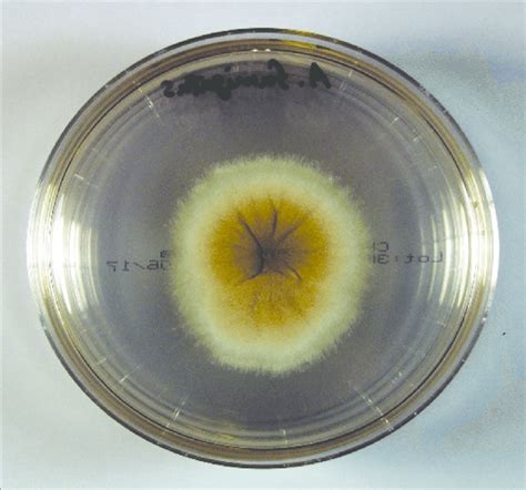 Sabouraud Dextrose Agar Medium Demonstrating Growth Of Aspergillus