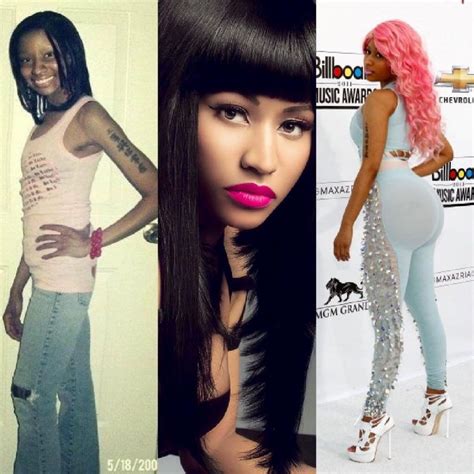 Nicki Minaj Before And After Pictures