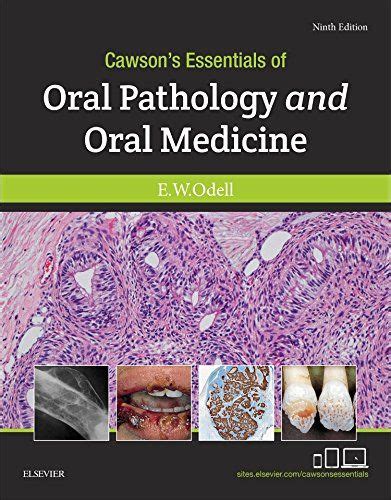 Cawsons Essentials Of Oral Pathology And Oral Medicine
