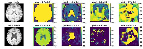 Localised Sex Classification On A 20 Year Old Male Subject First Row