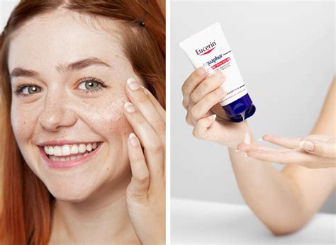 The Eucerin Aquaphor Review Youve Been Searching For LaptrinhX News