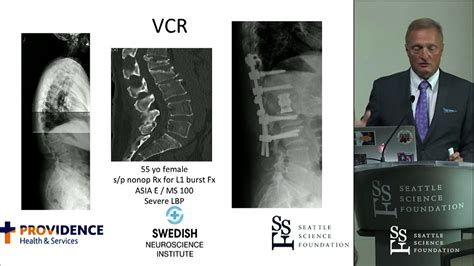 Three Column Osteotomy For Correction Of Spinal Deformities Jens R