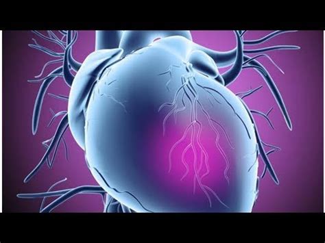 Infezioni virali, infezioni batteriche, infezioni micotiche, malattie autoimmuni o genericamente infiammatorie, malattia di chagas (tripanosomiasi americana). L'infiammazione del cuore: come si cura la miocardite ...