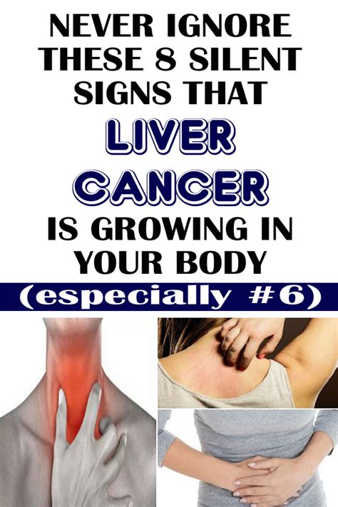 8 Silent Signs Of Liver Cancer You Should Not Ignore