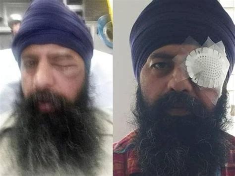 Sikh Mans Turban Knocked Off Hair Cut In Alleged Hate
