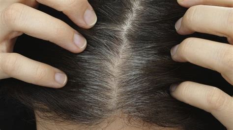 Cause Of Grey Hair May Be Stuck Cells Say Scientists Bbc News