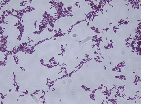 Bacillus Gram Stain Images And Pictures Becuo
