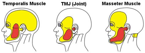 Tmj Pain Jaw Pain Causes Symptoms And Relation To Neck Pain