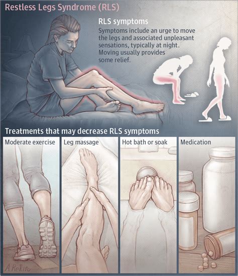 Restless Legs Syndrome Gets A Real Starting Point For Potential Treatments Innovation Toronto