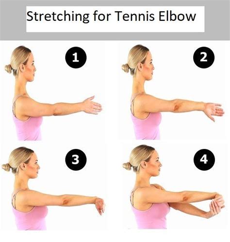 Lateral Epicondylitis Tennis Elbow Causes Symptoms Treatment How To Relief Tennis Elbow