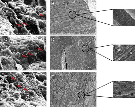 Aef Scanning Electron Microscopy Of Bacterial Colonization With