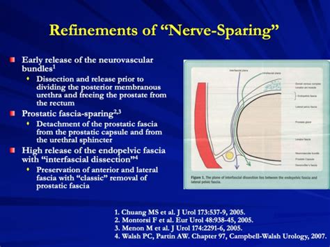 Cavernous Nerve Restorative Thx To Preserve Erectile Function After Rp