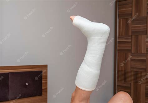 Premium Photo Broken Leg Ankle And Foot Splint Bandages On The Legs