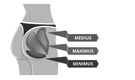A Weak Butt Causes Hip Pain Myodetox