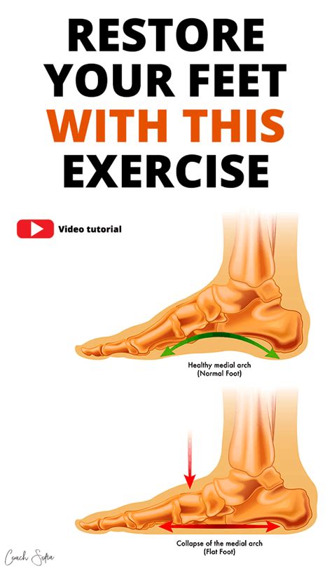 Fix Flat Feet With This One Simple Exercise Coach Sofia Fitness