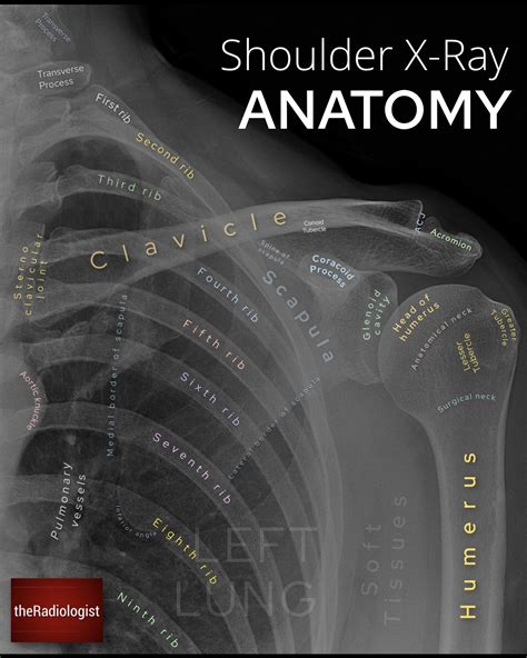 Shoulder X Ray Anatomy