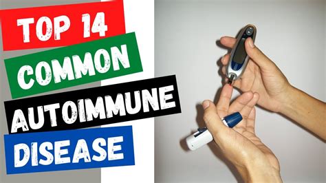 Top 14 Common Autoimmune Diseases Youtube