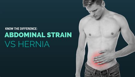 Inguinal Hernia Symptoms And Treatment Health Inputs The Best Porn