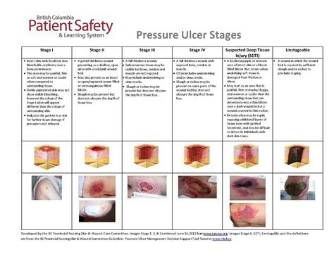 Pressure Ulcer Grade Chart