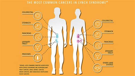 Living With Lynch Syndrome Everyday Health