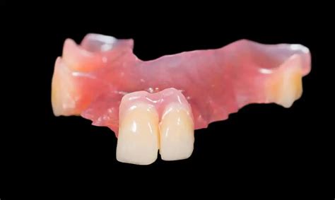 Partial Dentures Cost Uk Types Materials Pros And Cons