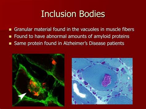 Ppt Inclusion Body Myositis Powerpoint Presentation Id4073591