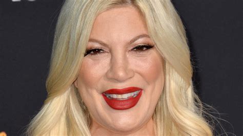 Tori Spelling Reveals What Kind Of Plastic Surgery Shes Getting