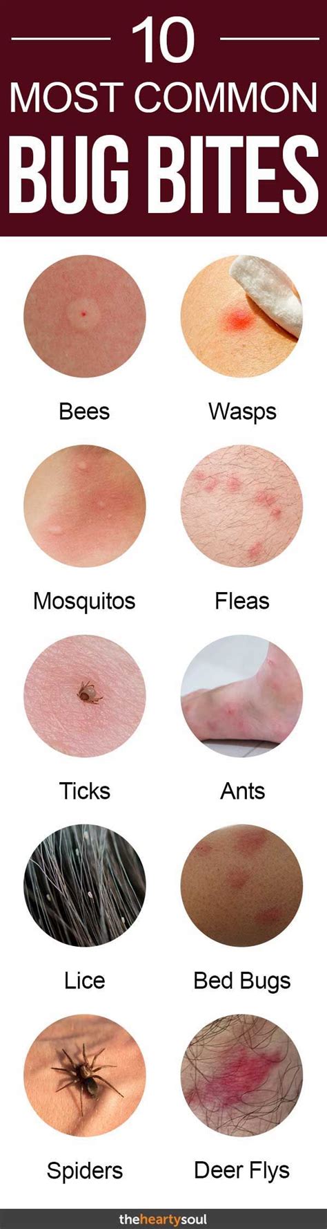 Mosquito Bites From Different Species Peepsburgh